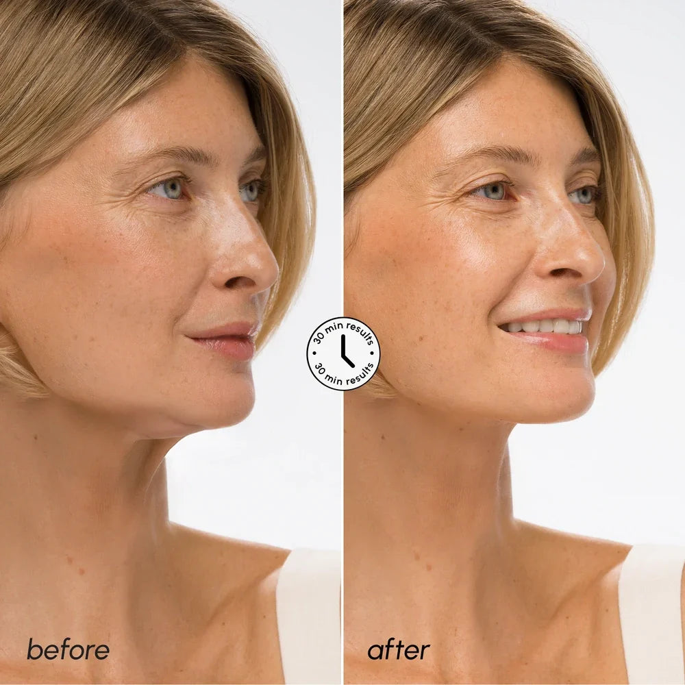 Hyaluronic Acid V-Line Lifting Mask – Sculpt Jawline & Firm Neck Skin