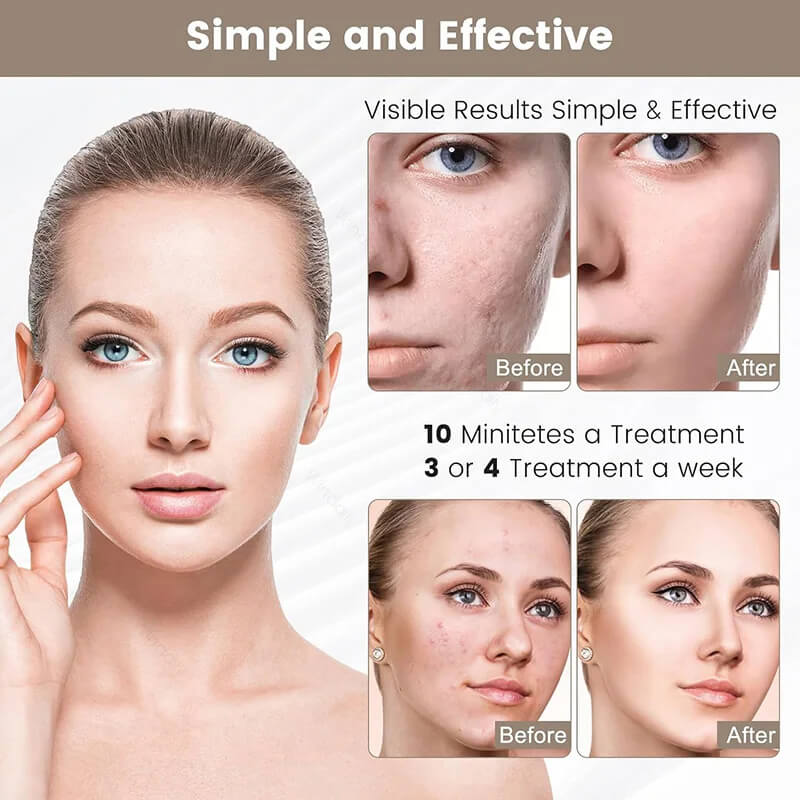 7-Color LED Light Therapy Face Mask – Anti-Aging & Acne Treatment at Home
